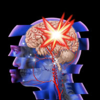 traumatic brain injury traumatic brain injury