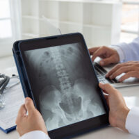 spinal cord injury attorney